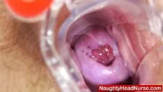Reproducir Hold yaws su agujero barbate
